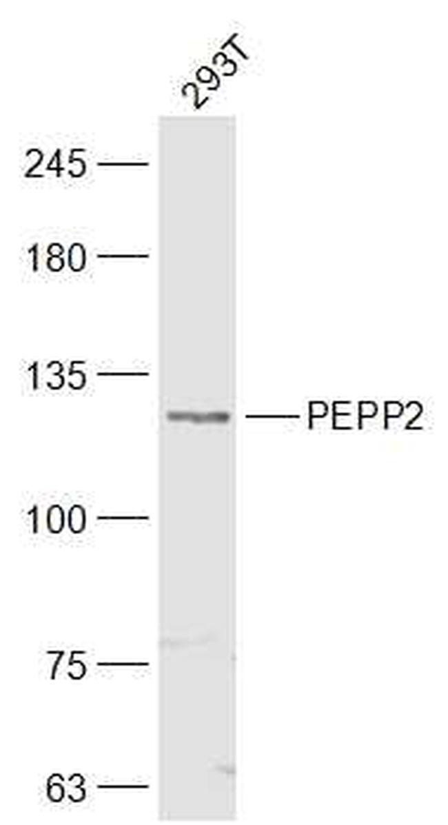 PEPP2 Antibody in Western Blot (WB)