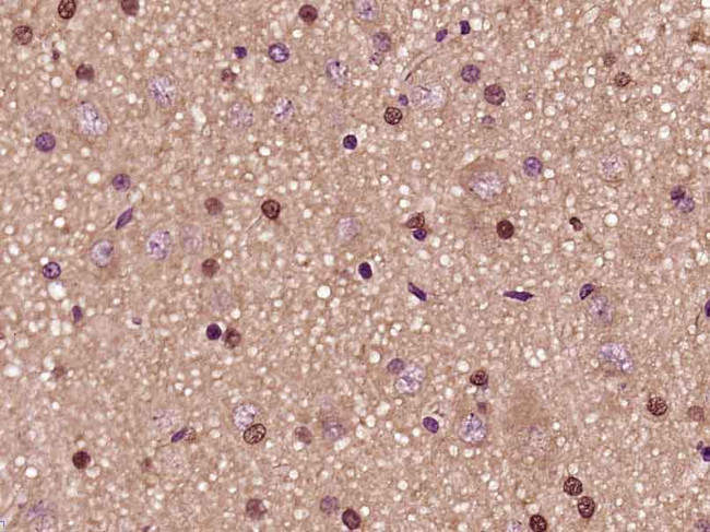 PFKFB3/PFK2 Antibody in Immunohistochemistry (Paraffin) (IHC (P))