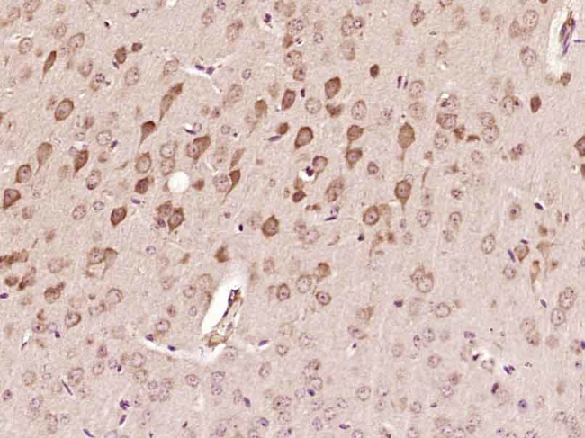 SMCR7 Antibody in Immunohistochemistry (Paraffin) (IHC (P))