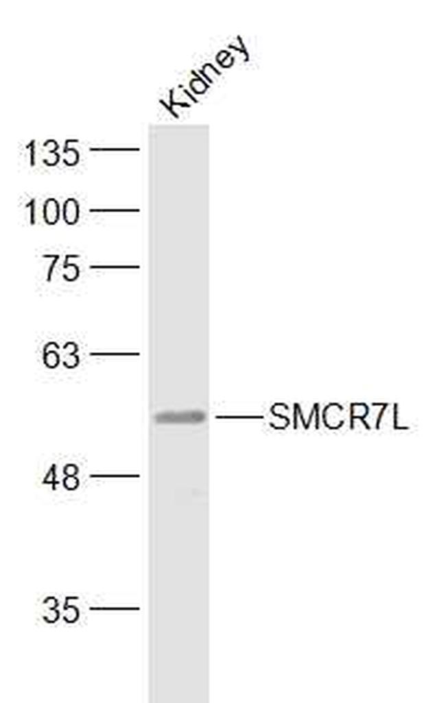 SMCR7L Antibody in Western Blot (WB)