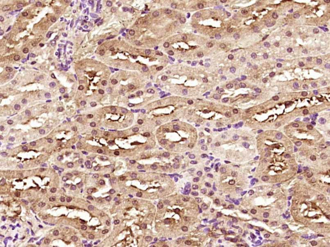 SMYD5 Antibody in Immunohistochemistry (Paraffin) (IHC (P))