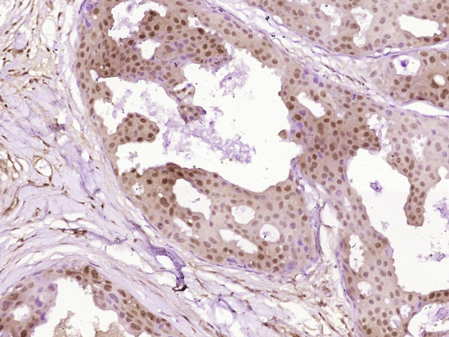 SNF2H Antibody in Immunohistochemistry (Paraffin) (IHC (P))