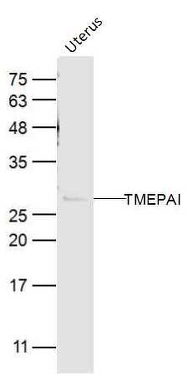 TMEPAI Antibody in Western Blot (WB)
