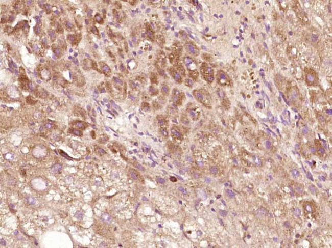 TMPRSS11D Antibody in Immunohistochemistry (Paraffin) (IHC (P))