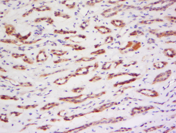 PRAM1 Antibody in Immunohistochemistry (Paraffin) (IHC (P))
