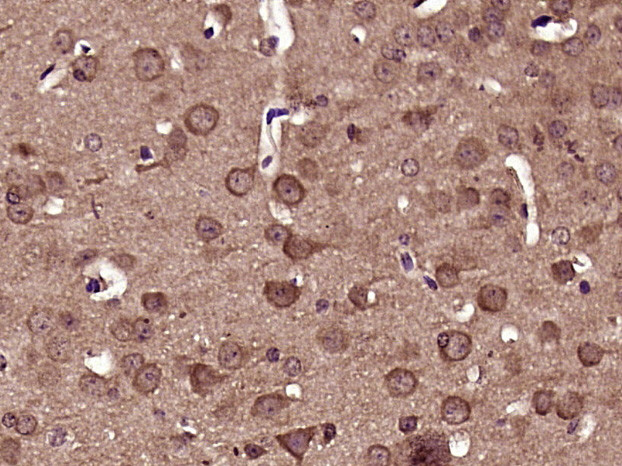 Phospho-DRP1 (Ser616) Antibody in Immunohistochemistry (Paraffin) (IHC (P))