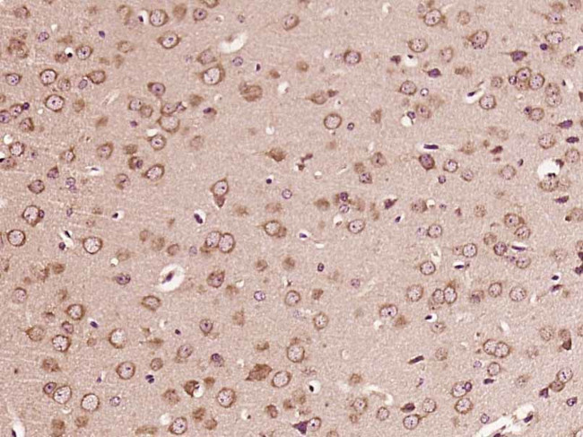 B4GALNT1/GM2 synthase Antibody in Immunohistochemistry (Paraffin) (IHC (P))