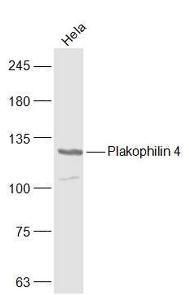Plakophilin 4 Antibody in Western Blot (WB)