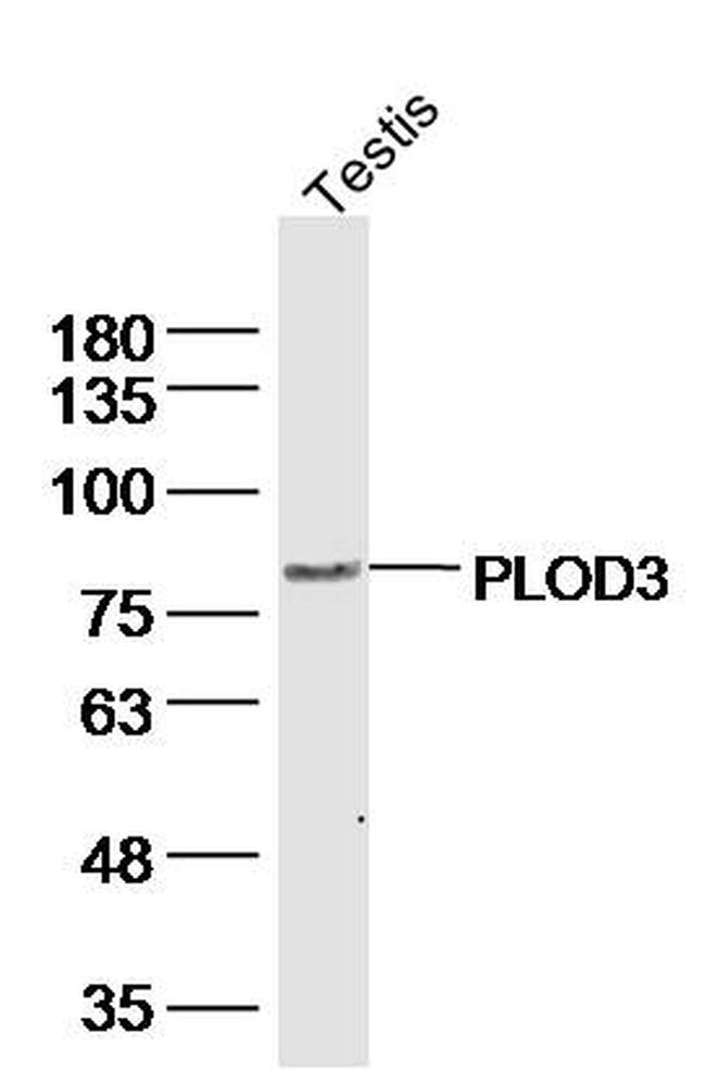 PLOD3 Antibody in Western Blot (WB)