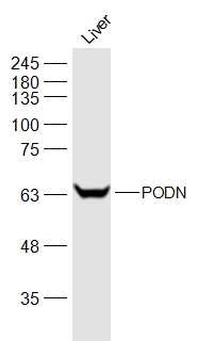 PODN Antibody in Western Blot (WB)