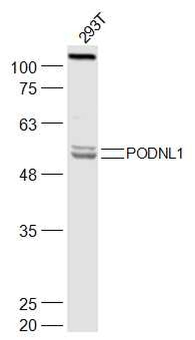 PODNL1 Antibody in Western Blot (WB)