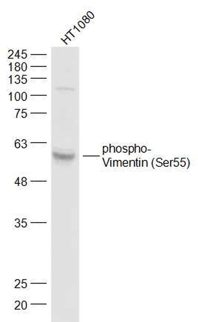 Phospho-Vimentin (Ser55) Antibody in Western Blot (WB)