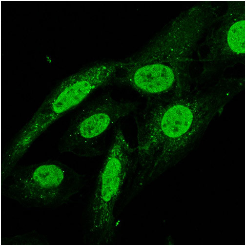 VPS13D Antibody in Immunocytochemistry (ICC/IF)