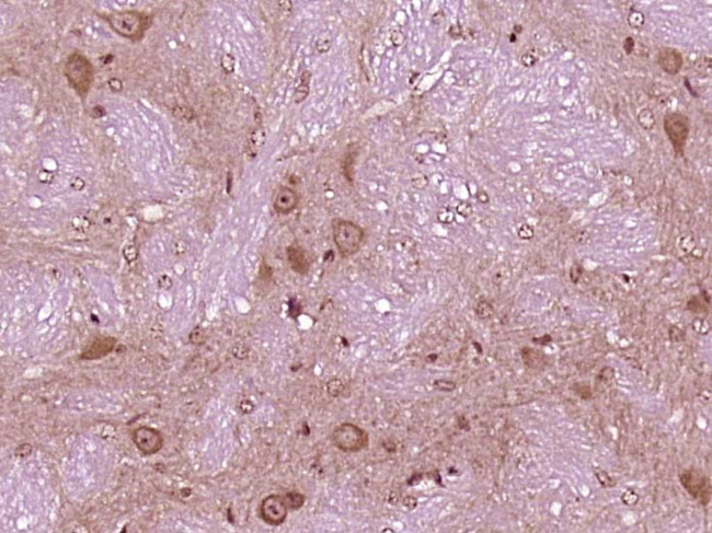 VPS29 Antibody in Immunohistochemistry (Paraffin) (IHC (P))