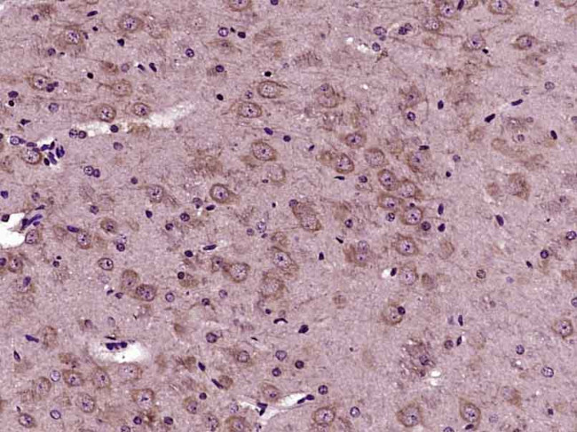VPS45A Antibody in Immunohistochemistry (Paraffin) (IHC (P))