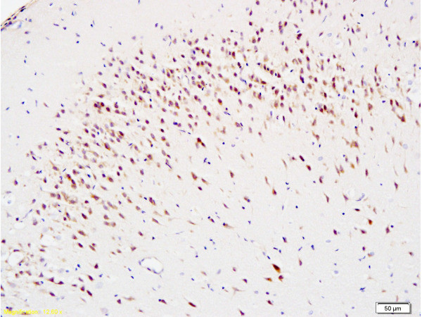 8-OHdG/8 Hydroxyguanosine Antibody in Immunohistochemistry (Paraffin) (IHC (P))
