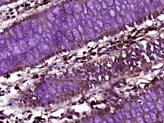 ZNF197 Antibody in Immunohistochemistry (Paraffin) (IHC (P))