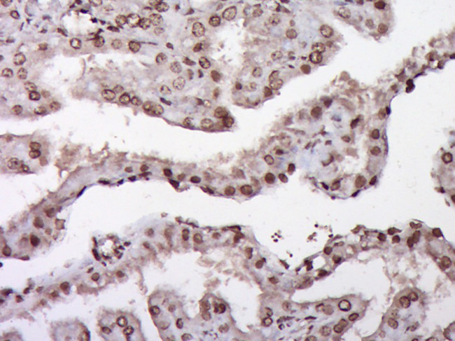 ZNF22 Antibody in Immunohistochemistry (Paraffin) (IHC (P))