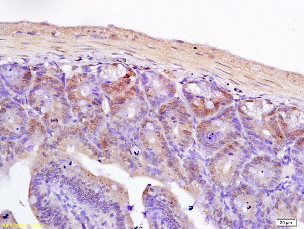 TCF7L2 Antibody in Immunohistochemistry (Paraffin) (IHC (P))