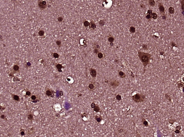ZNF447 Antibody in Immunohistochemistry (Paraffin) (IHC (P))