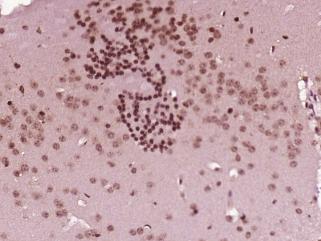 ZNF496 Antibody in Immunohistochemistry (Paraffin) (IHC (P))