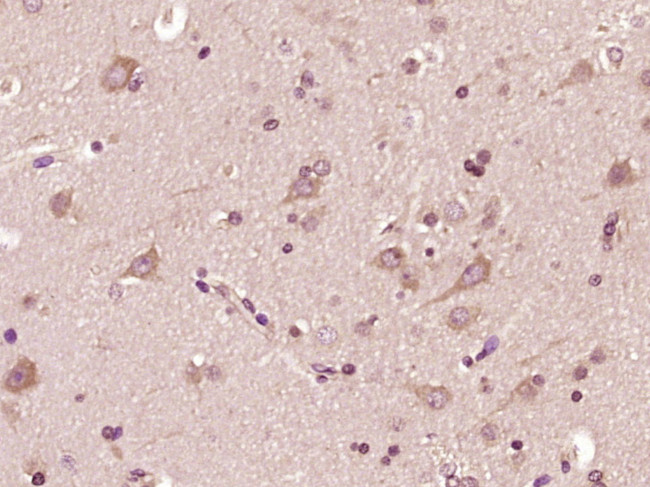 STK11IP Antibody in Immunohistochemistry (Paraffin) (IHC (P))