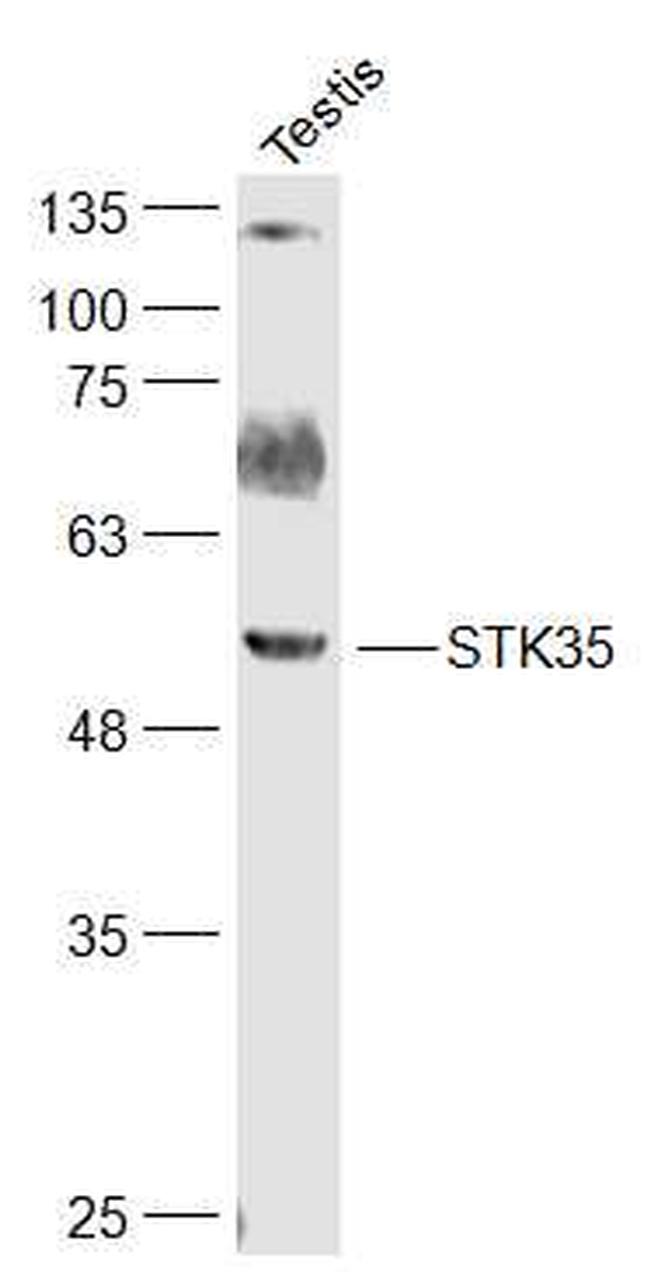 STK35 Antibody in Western Blot (WB)