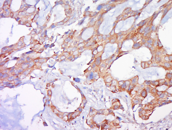 BAK Antibody in Immunohistochemistry (Paraffin) (IHC (P))