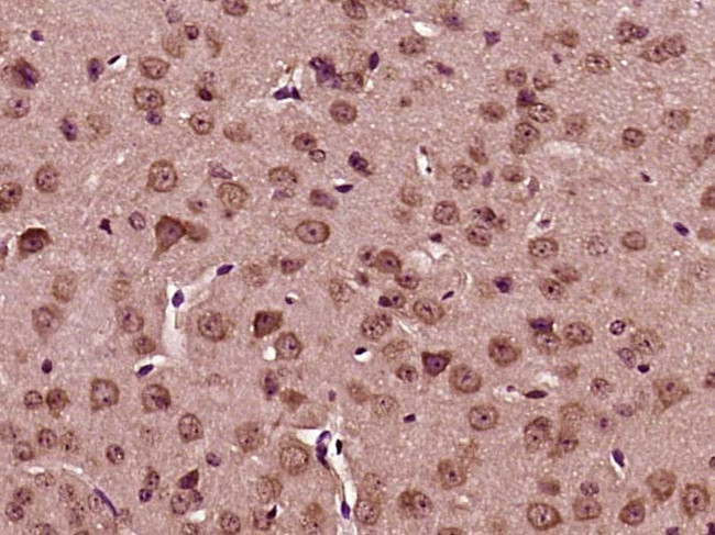 BRAF35 Antibody in Immunohistochemistry (Paraffin) (IHC (P))
