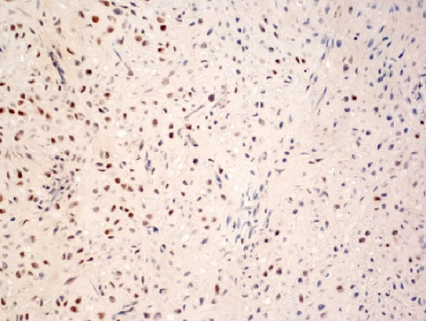 Phospho-c-Fos (Ser362) Antibody in Immunohistochemistry (Paraffin) (IHC (P))