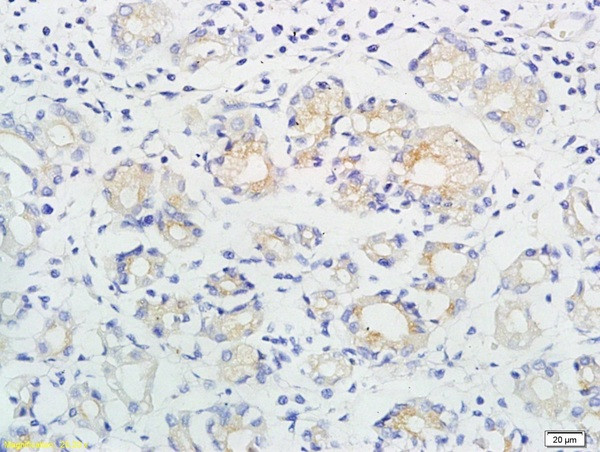 ING1/p33ING1b Antibody in Immunohistochemistry (Paraffin) (IHC (P))
