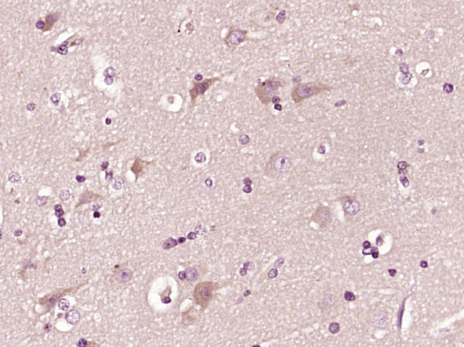 CTRP2 Antibody in Immunohistochemistry (Paraffin) (IHC (P))