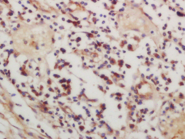 Phospho-CSK (Ser364) Antibody in Immunohistochemistry (Paraffin) (IHC (P))