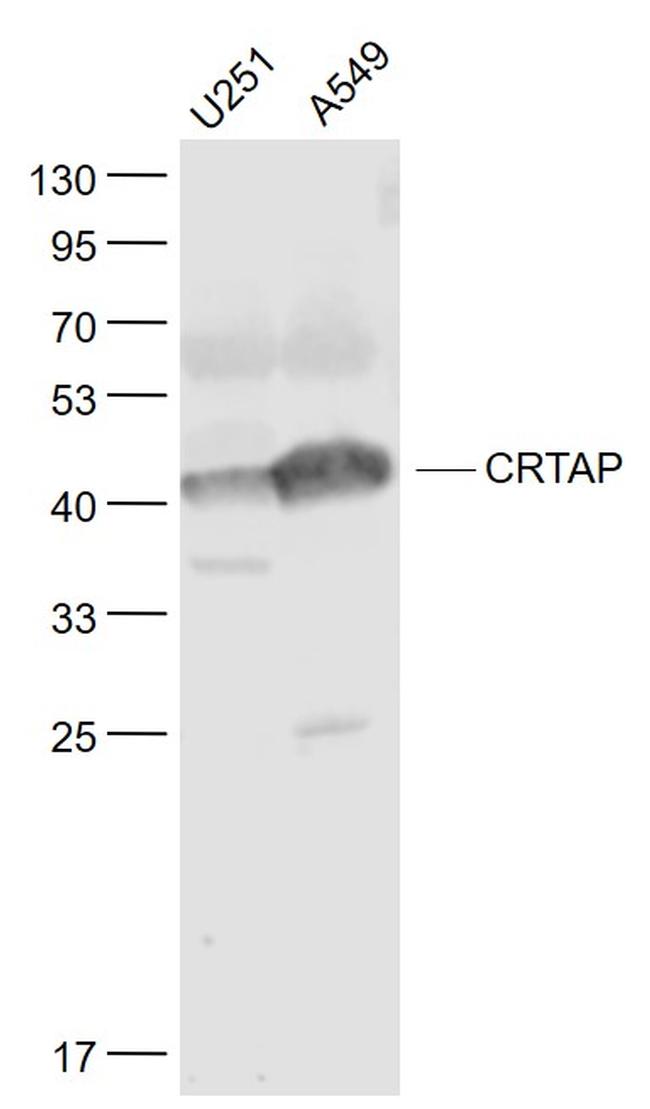 CRTAP Antibody in Western Blot (WB)