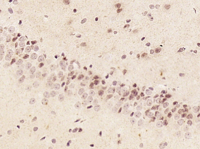 Phospho-alpha B Crystallin (Ser59) Antibody in Immunohistochemistry (Paraffin) (IHC (P))