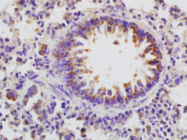 beta defensin 2 Antibody in Immunohistochemistry (Paraffin) (IHC (P))