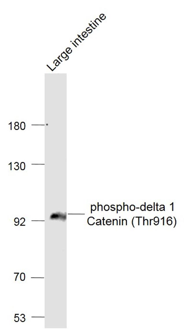 Phospho-delta 1 Catenin (Thr916) Antibody in Western Blot (WB)