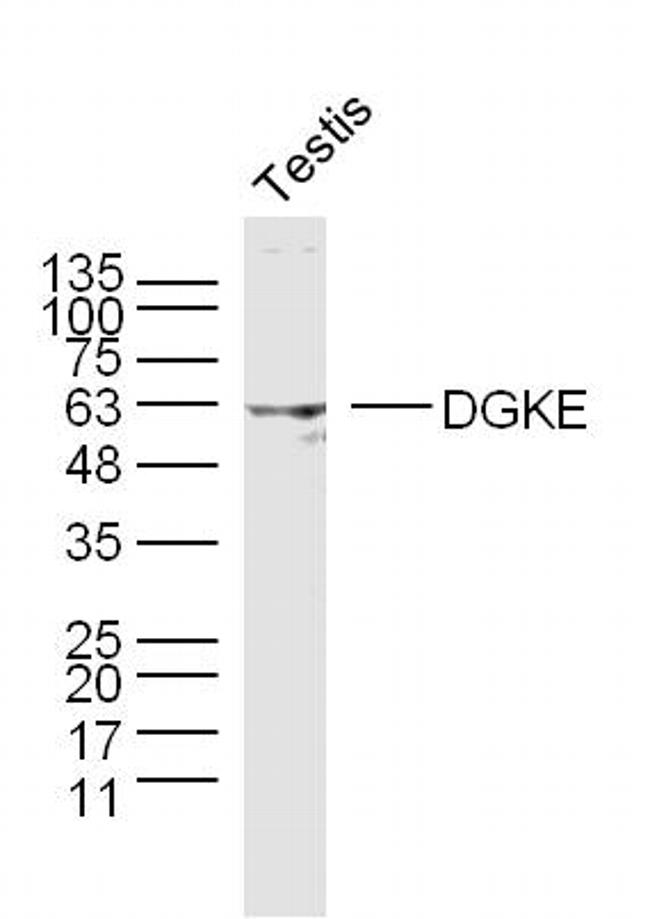 DGKE Antibody in Western Blot (WB)