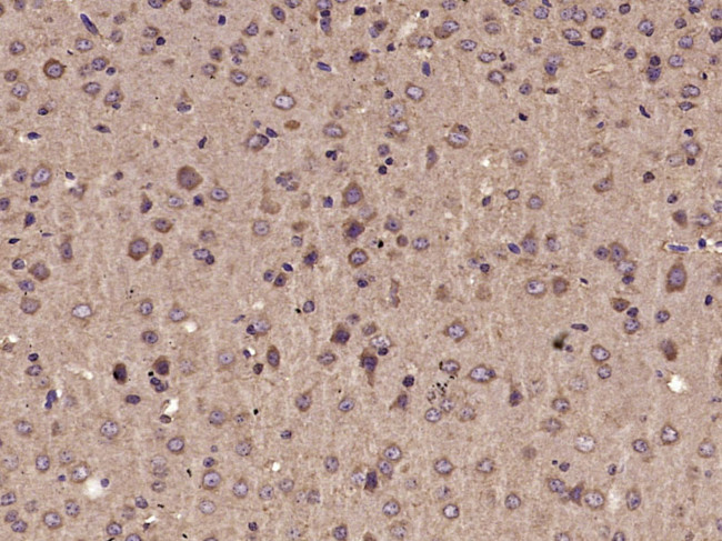 Parvalbumin Antibody in Immunohistochemistry (Paraffin) (IHC (P))
