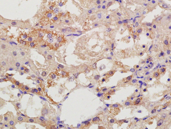 DIAPH2/Dia2 Antibody in Immunohistochemistry (Paraffin) (IHC (P))