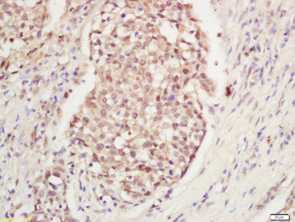 DNA Polymerase gamma Antibody in Immunohistochemistry (Paraffin) (IHC (P))