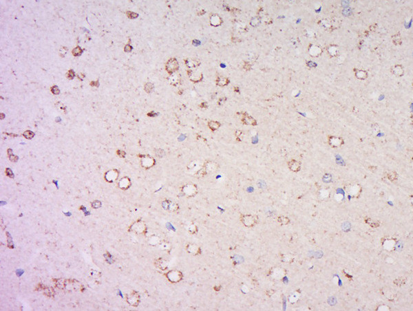 DNA Polymerase iota Antibody in Immunohistochemistry (Paraffin) (IHC (P))