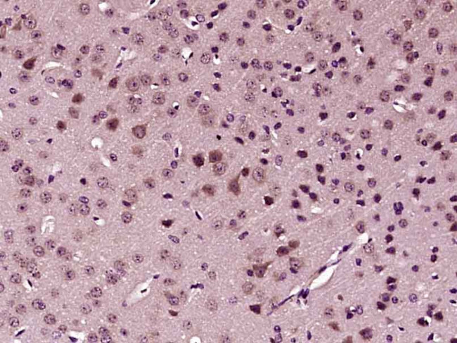 SFRP1 Antibody in Immunohistochemistry (Paraffin) (IHC (P))