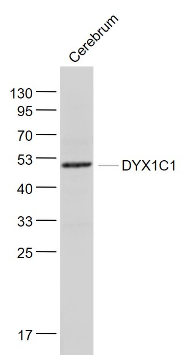 DYX1C1 Antibody in Western Blot (WB)