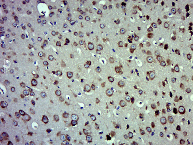 eEF1A1+2 Antibody in Immunohistochemistry (Paraffin) (IHC (P))