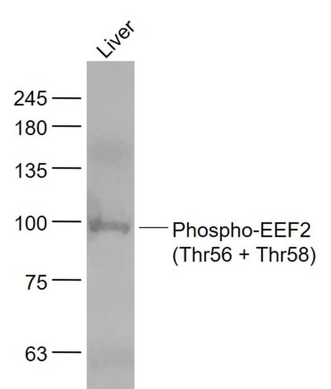 Phospho-EEF2 (Thr56, Thr58) Antibody in Western Blot (WB)