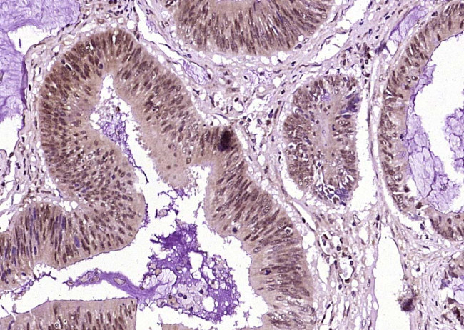 Phospho-HER2 (Tyr1222) Antibody in Immunohistochemistry (Paraffin) (IHC (P))