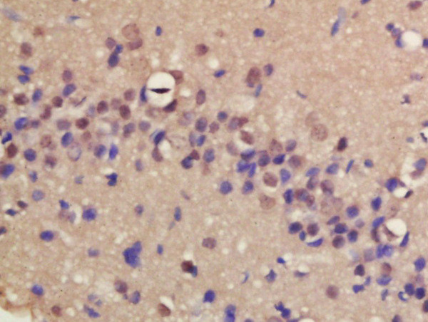 ERCC8/CSA Antibody in Immunohistochemistry (Paraffin) (IHC (P))