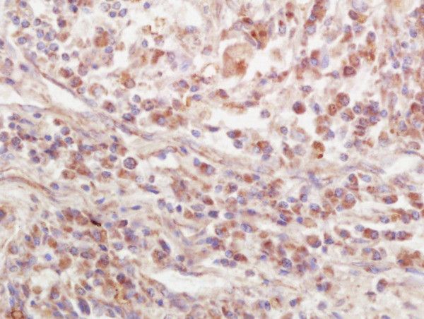 EPS15R Antibody in Immunohistochemistry (Paraffin) (IHC (P))