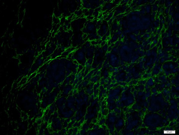 ETL/ELTD1 Antibody in Immunohistochemistry (Paraffin) (IHC (P))